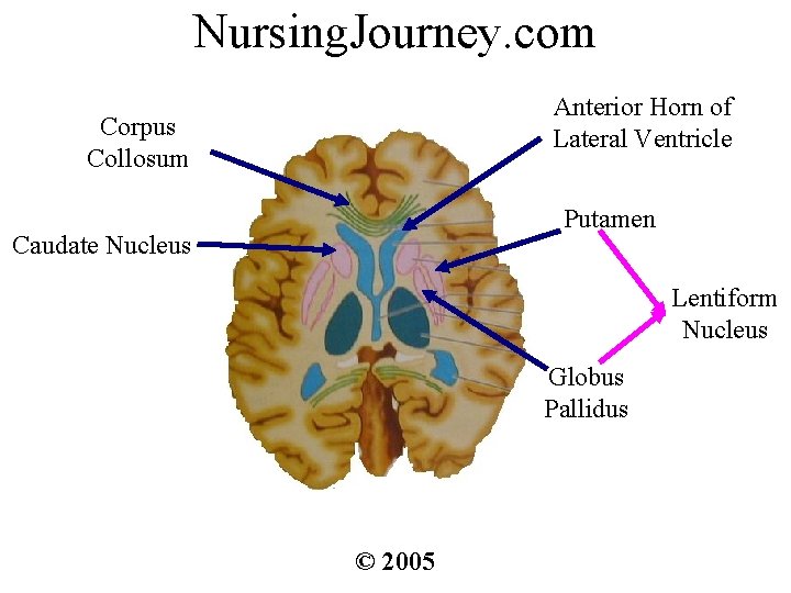 Nursing. Journey. com Anterior Horn of Lateral Ventricle Corpus Collosum Putamen Caudate Nucleus Lentiform