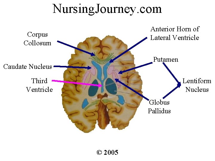 Nursing. Journey. com Anterior Horn of Lateral Ventricle Corpus Collosum Putamen Caudate Nucleus Third