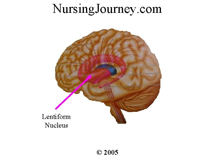 Nursing. Journey. com Lentiform Nucleus © 2005 