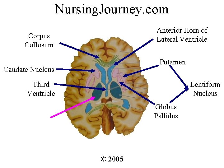 Nursing. Journey. com Anterior Horn of Lateral Ventricle Corpus Collosum Putamen Caudate Nucleus Third