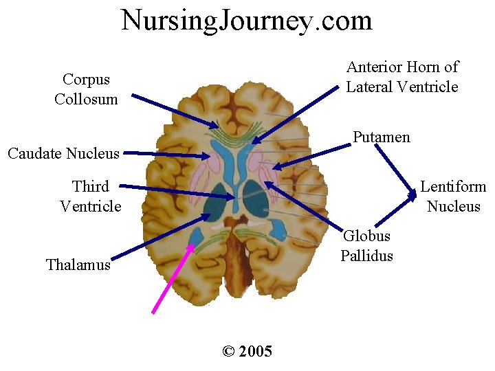 Nursing. Journey. com Anterior Horn of Lateral Ventricle Corpus Collosum Putamen Caudate Nucleus Third