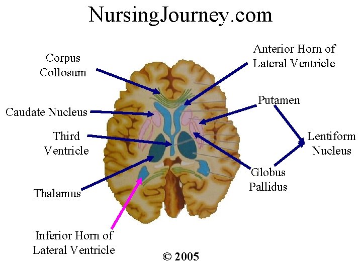 Nursing. Journey. com Anterior Horn of Lateral Ventricle Corpus Collosum Putamen Caudate Nucleus Third