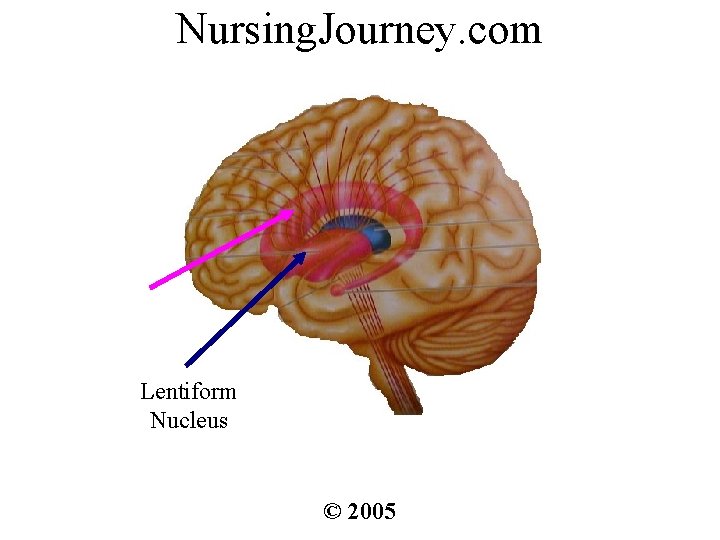 Nursing. Journey. com Lentiform Nucleus © 2005 