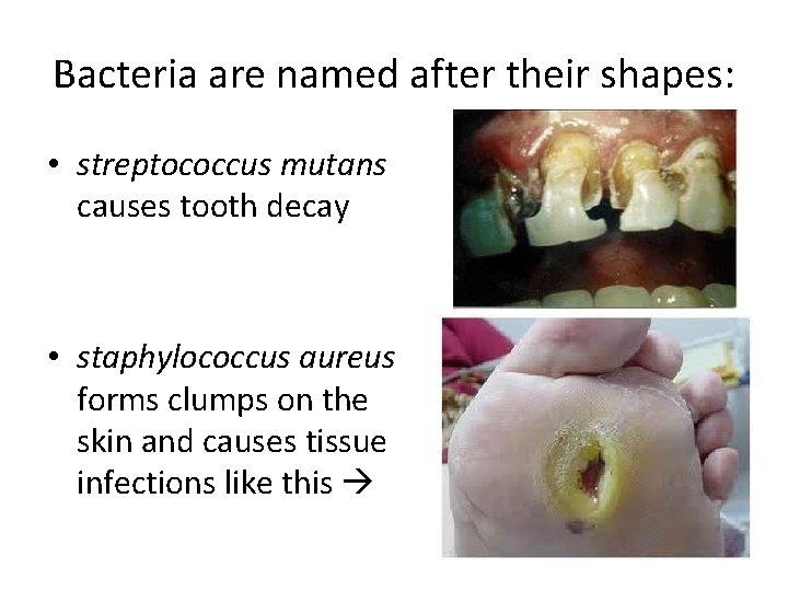 Bacteria are named after their shapes: • streptococcus mutans causes tooth decay • staphylococcus
