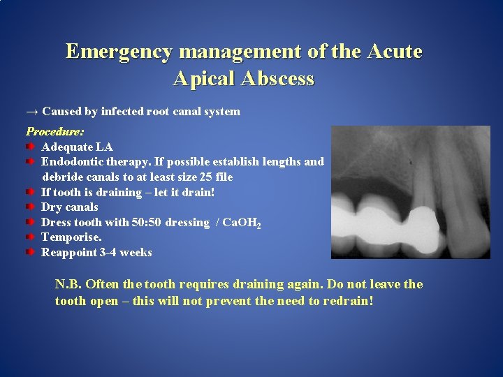 Emergency management of the Acute Apical Abscess → Caused by infected root canal system