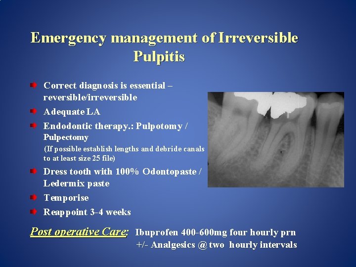 Emergency management of Irreversible Pulpitis Correct diagnosis is essential – reversible/irreversible Adequate LA Endodontic