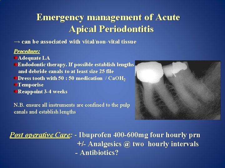 Emergency management of Acute Apical Periodontitis → can be associated with vital/non-vital tissue Procedure: