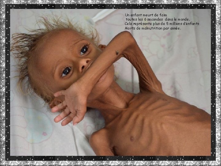 Un enfant meurt de faim toutes les 6 secondes dans le monde. Cela représente