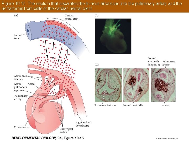 Figure 10. 15 The septum that separates the truncus arteriosus into the pulmonary artery