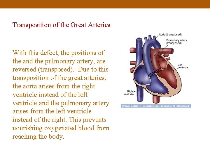 Transposition of the Great Arteries With this defect, the positions of the and the