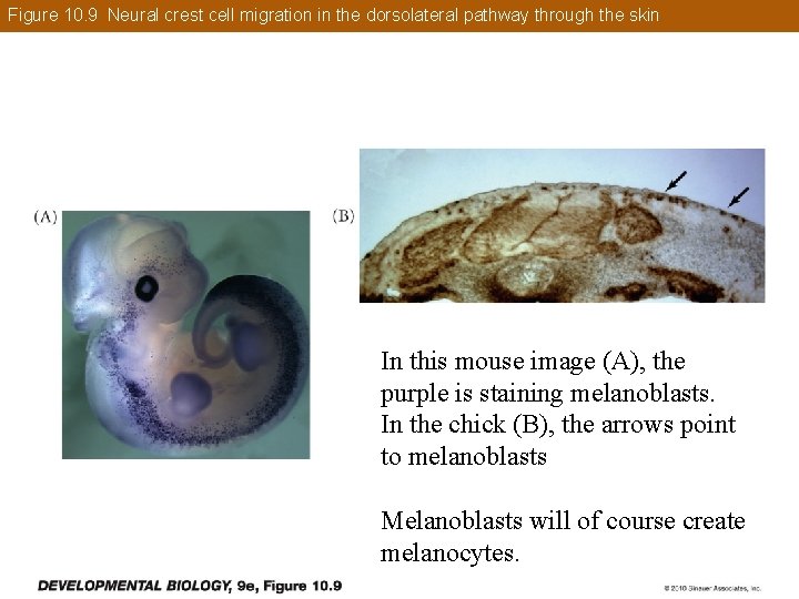 Figure 10. 9 Neural crest cell migration in the dorsolateral pathway through the skin