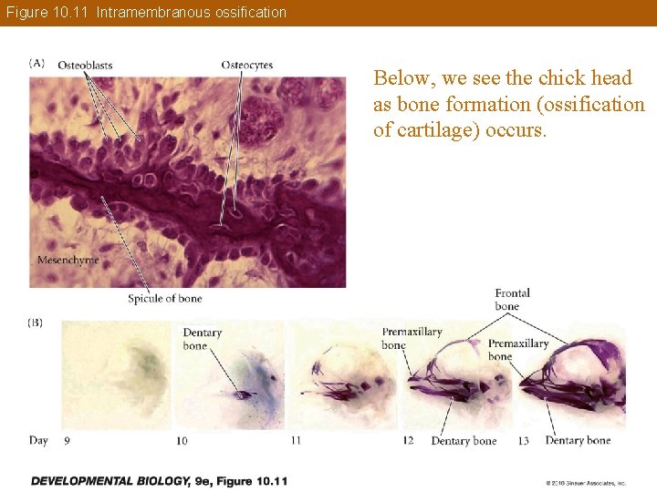 Figure 10. 11 Intramembranous ossification Below, we see the chick head as bone formation