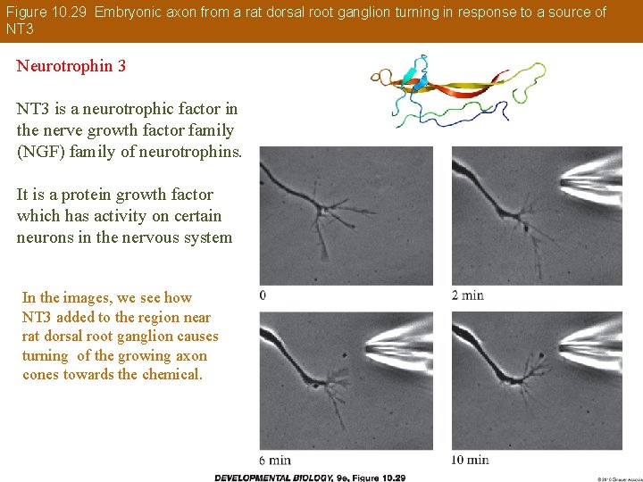Figure 10. 29 Embryonic axon from a rat dorsal root ganglion turning in response