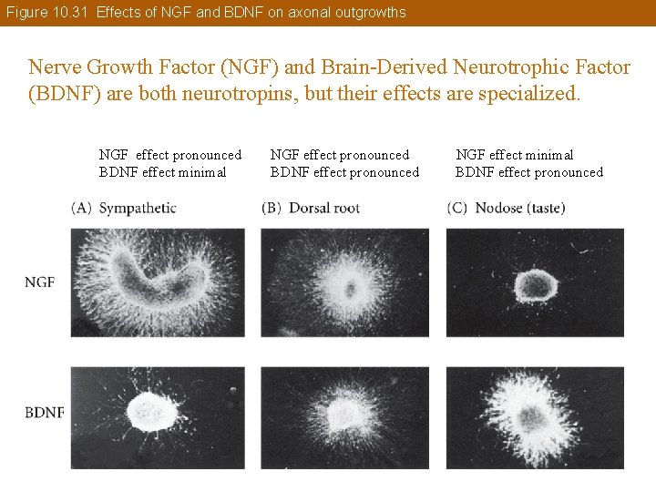 Figure 10. 31 Effects of NGF and BDNF on axonal outgrowths Nerve Growth Factor