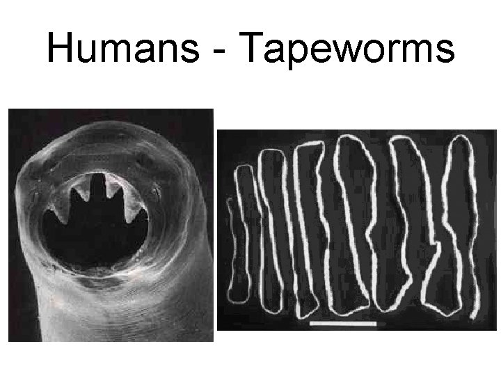 Humans - Tapeworms 
