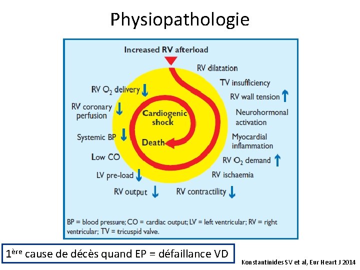 Physiopathologie 1ère cause de décès quand EP = défaillance VD Konstantinides SV et al,