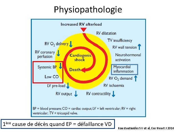 Physiopathologie 1ère cause de décès quand EP = défaillance VD Konstantinides SV et al,