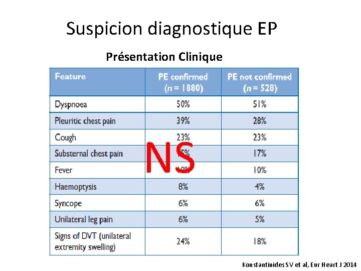 Suspicion diagnostique EP Présentation Clinique NS Konstantinides SV et al, Eur Heart J 2014