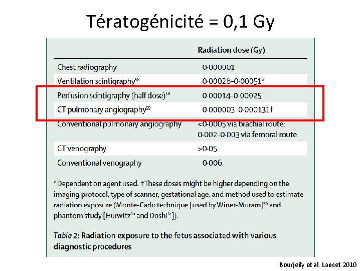 Tératogénicité = 0, 1 Gy Bourjeily et al. Lancet 2010 