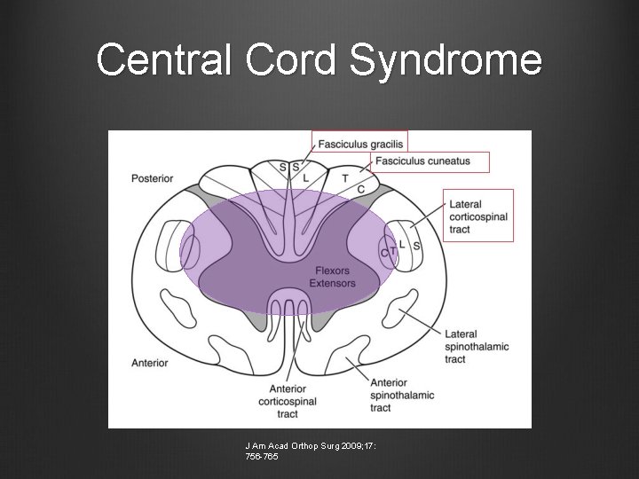 Central Cord Syndrome J Am Acad Orthop Surg 2009; 17: 756 -765 