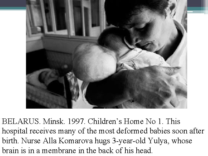 BELARUS. Minsk. 1997. Children’s Home No 1. This hospital receives many of the most