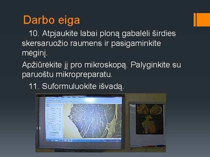 Darbo eiga 10. Atpjaukite labai ploną gabalėli širdies skersaruožio raumens ir pasigaminkite mėginį. Apžiūrėkite