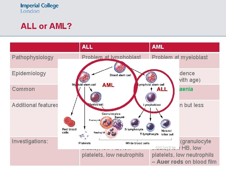 ALL or AML? ALL AML Pathophysiology Problem at lymphoblast stage Problem at myeloblast stage