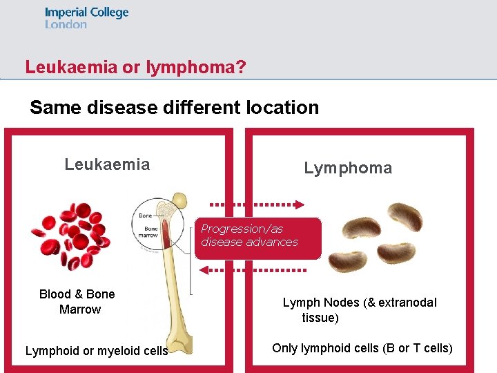 Leukaemia or lymphoma? Same disease different location Leukaemia Lymphoma Progression/as disease advances Blood &