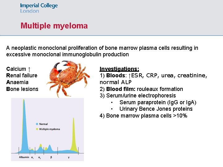 Multiple myeloma A neoplastic monoclonal proliferation of bone marrow plasma cells resulting in excessive