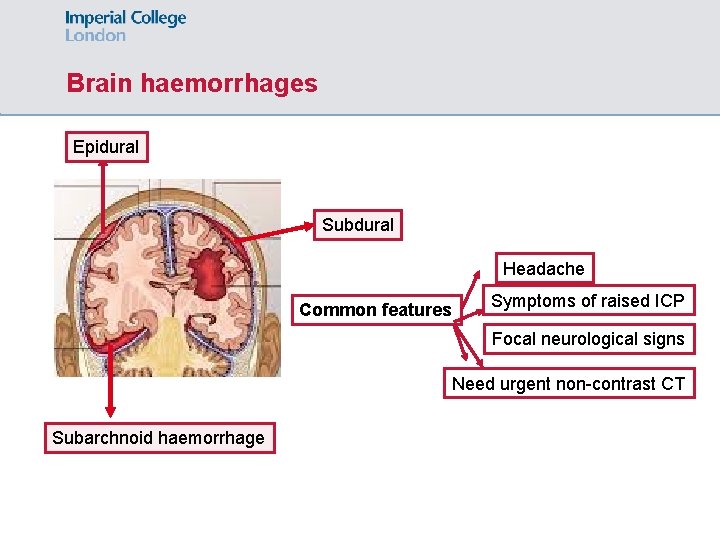 Brain haemorrhages Epidural Subdural Headache Common features Symptoms of raised ICP Focal neurological signs