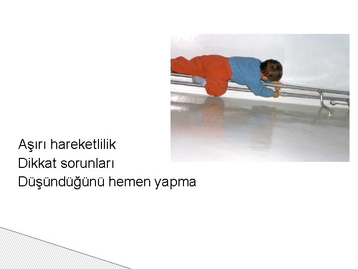 Aşırı hareketlilik Dikkat sorunları Düşündüğünü hemen yapma 