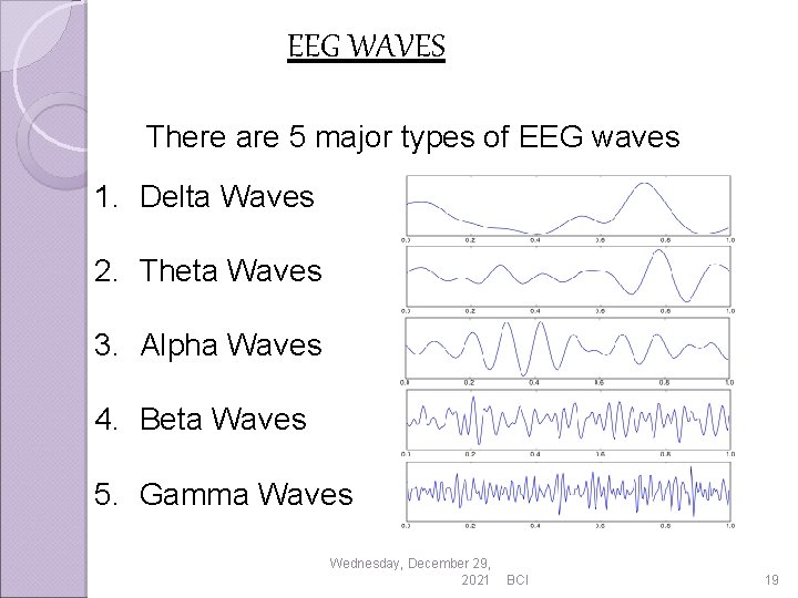 EEG WAVES There are 5 major types of EEG waves 1. Delta Waves 2.