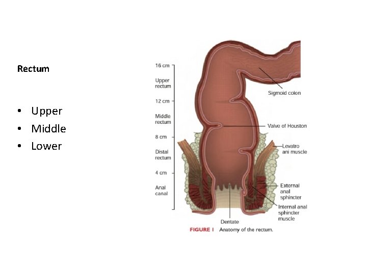 Rectum • Upper • Middle • Lower 