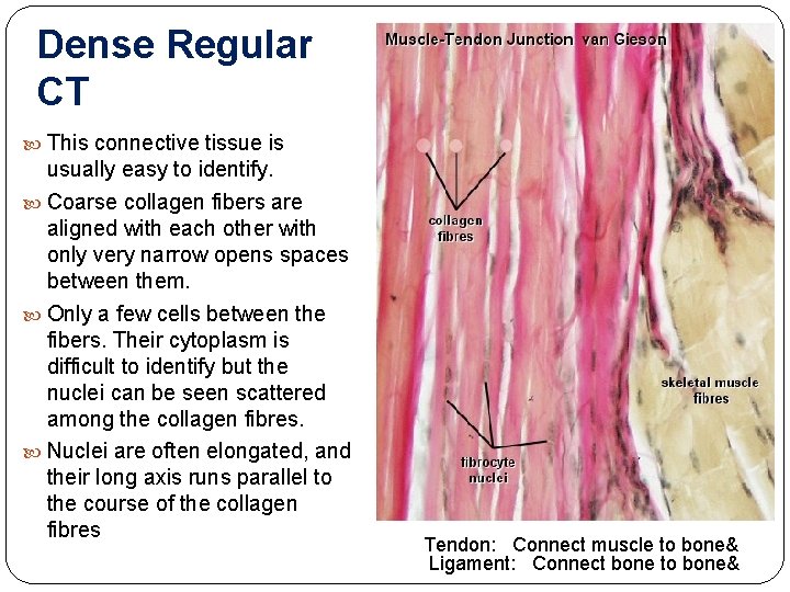 Dense Regular CT This connective tissue is usually easy to identify. Coarse collagen fibers
