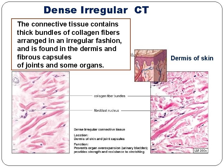 Dense Irregular CT The connective tissue contains thick bundles of collagen fibers arranged in