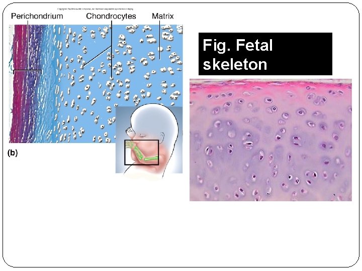 Fig. Fetal skeleton 35 