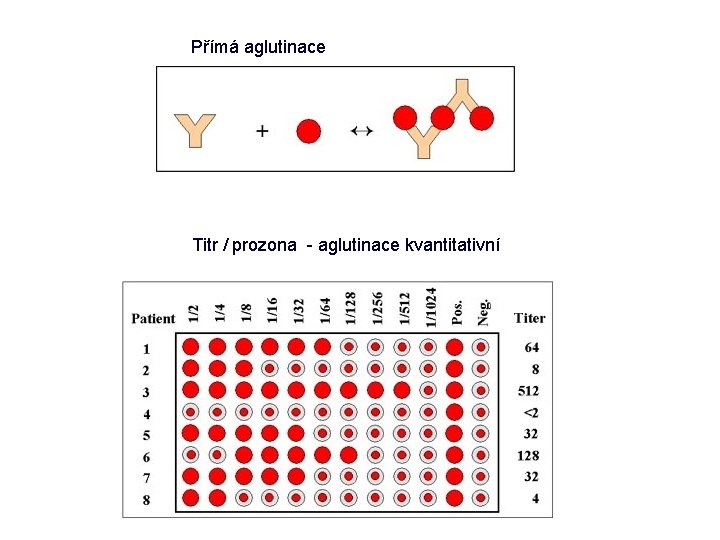 Přímá aglutinace Titr / prozona - aglutinace kvantitativní 