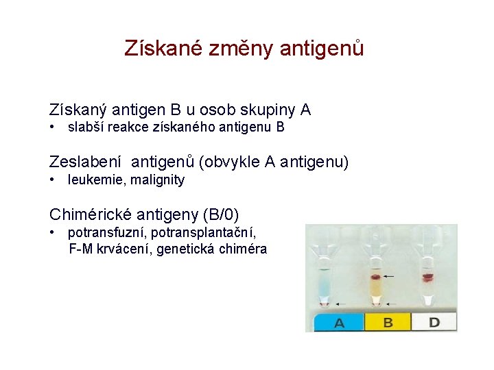 Získané změny antigenů Získaný antigen B u osob skupiny A • slabší reakce získaného