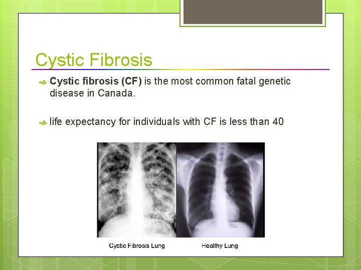 Cystic Fibrosis Cystic fibrosis (CF) is the most common fatal genetic disease in Canada.