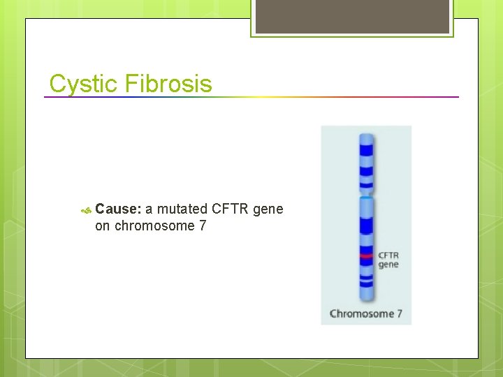 Cystic Fibrosis Cause: a mutated CFTR gene on chromosome 7 