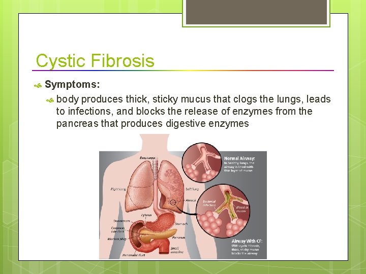 Cystic Fibrosis Symptoms: body produces thick, sticky mucus that clogs the lungs, leads to