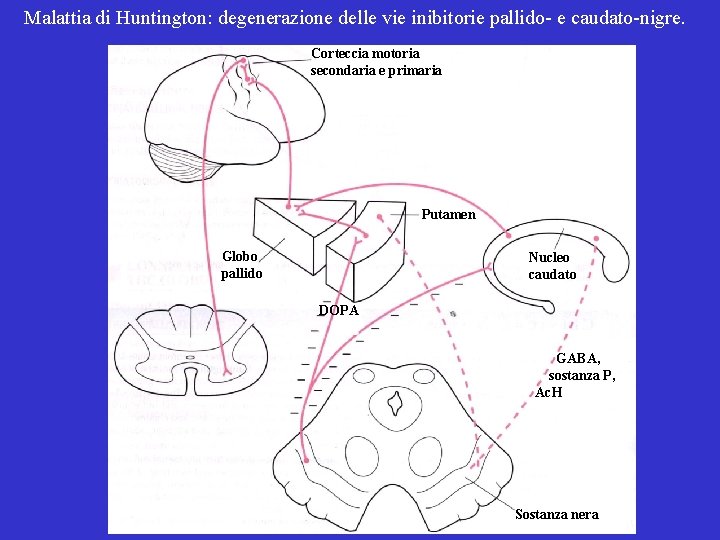 Malattia di Huntington: degenerazione delle vie inibitorie pallido- e caudato-nigre. Corteccia motoria secondaria e