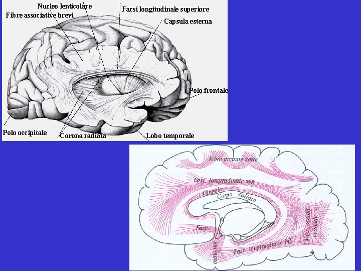 Nucleo lenticolare Fibre associative brevi Facsi longitudinale superiore Capsula esterna Polo frontale Polo occipitale