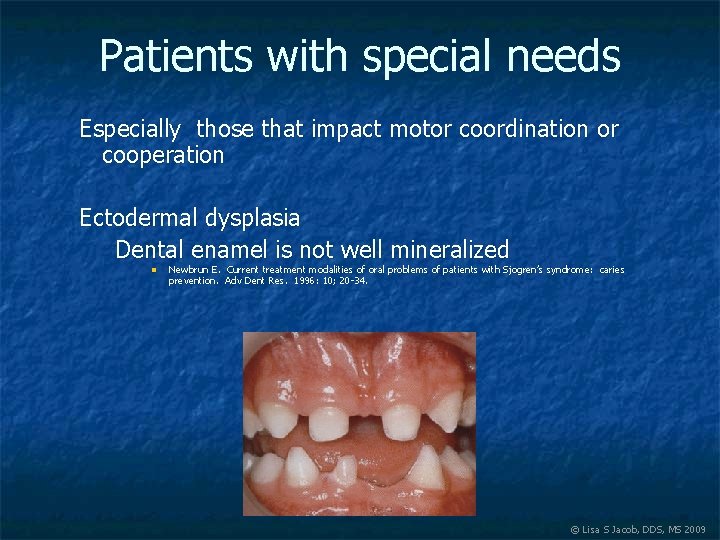 Patients with special needs Especially those that impact motor coordination or cooperation Ectodermal dysplasia