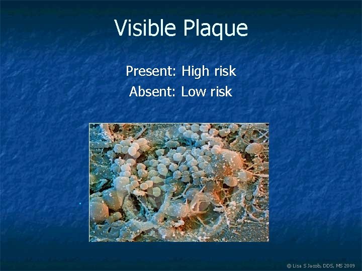 Visible Plaque Present: High risk Absent: Low risk n http: //www. scharfphoto. com/fine_art_prints/archives/199901 -024