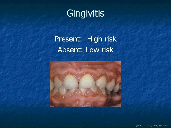 Gingivitis Present: High risk Absent: Low risk © Lisa S Jacob, DDS, MS 2009