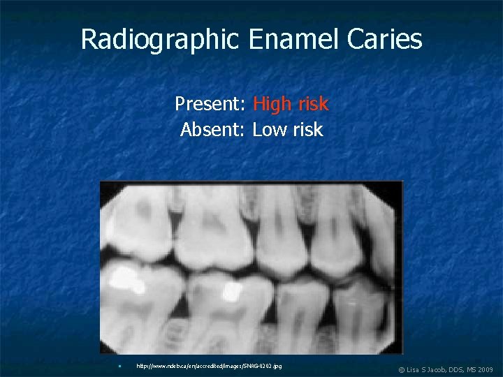 Radiographic Enamel Caries Present: High risk Absent: Low risk n http: //www. ndeb. ca/en/accredited/images/SNAG-0202.