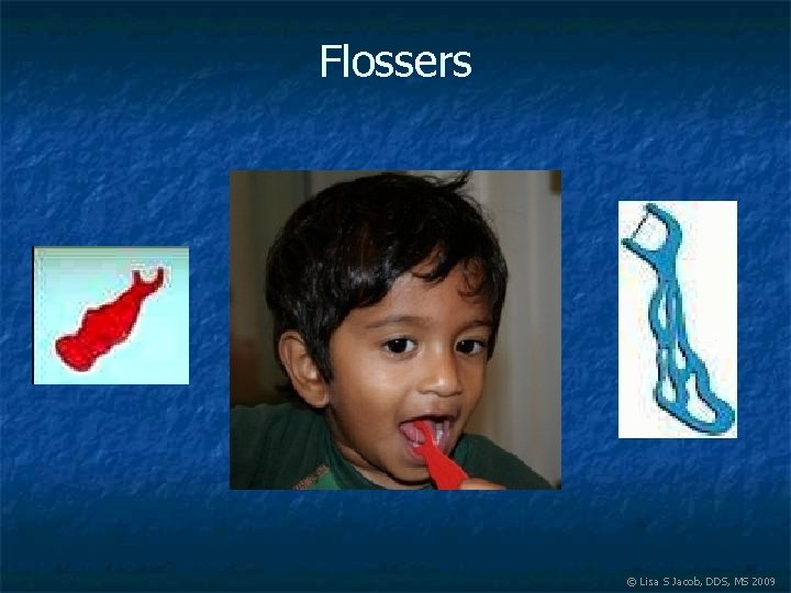 Flossers © Lisa S Jacob, DDS, MS 2009 