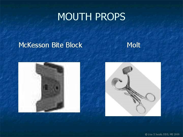 MOUTH PROPS Mc. Kesson Bite Block Molt © Lisa S Jacob, DDS, MS 2009