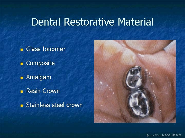 Dental Restorative Material n Glass Ionomer n Composite n Amalgam n Resin Crown n